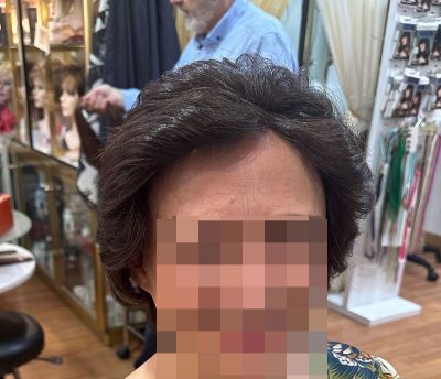 clienta-despues-de-la-colocacion-de-protesis-capilares-para-alopecia-frontal-fibrosante-recortada clienta despues de la colocacion de protesis capilares para alopecia frontal fibrosante